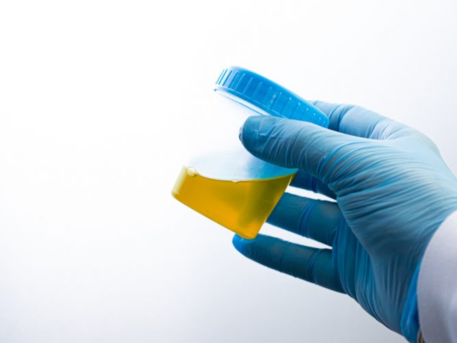 Test de drogas básico / 5 sustancias